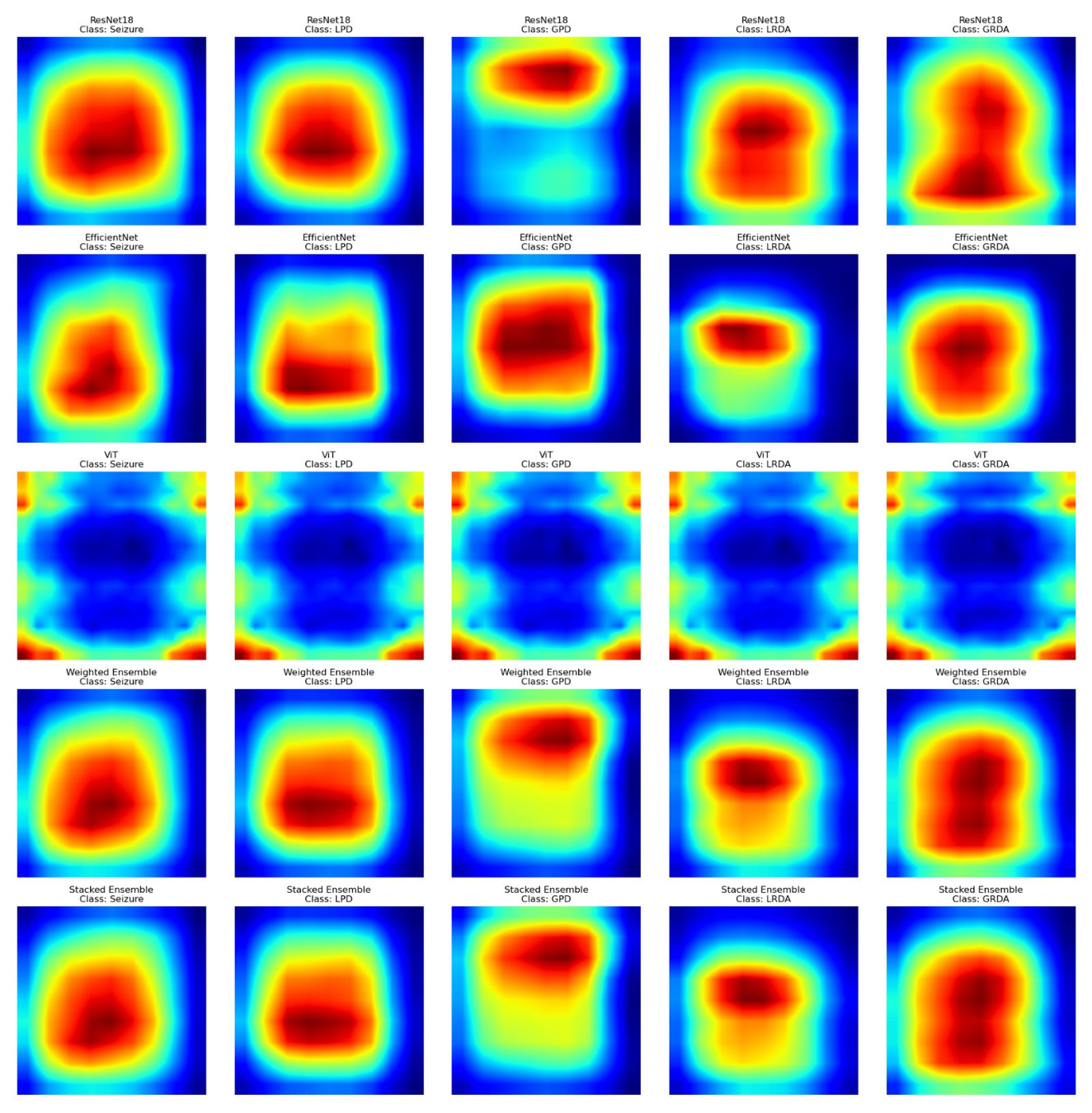 EEG-based Harmful Brain Activity Classification using Deep Learning